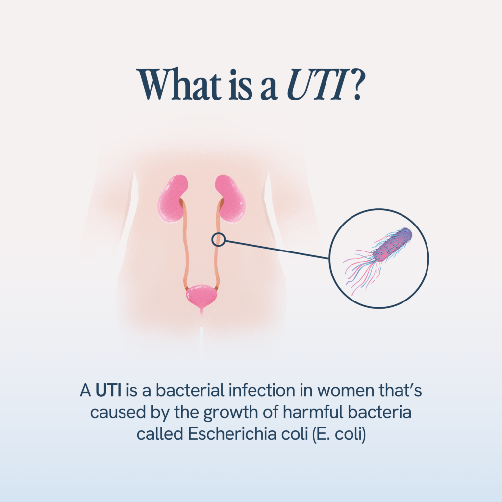 A UTI, or urinary tract infection, is a bacterial infection in women, commonly caused by the bacterium Escherichia coli (E. coli), depicted as an illustration next to a diagram of the female urinary system.