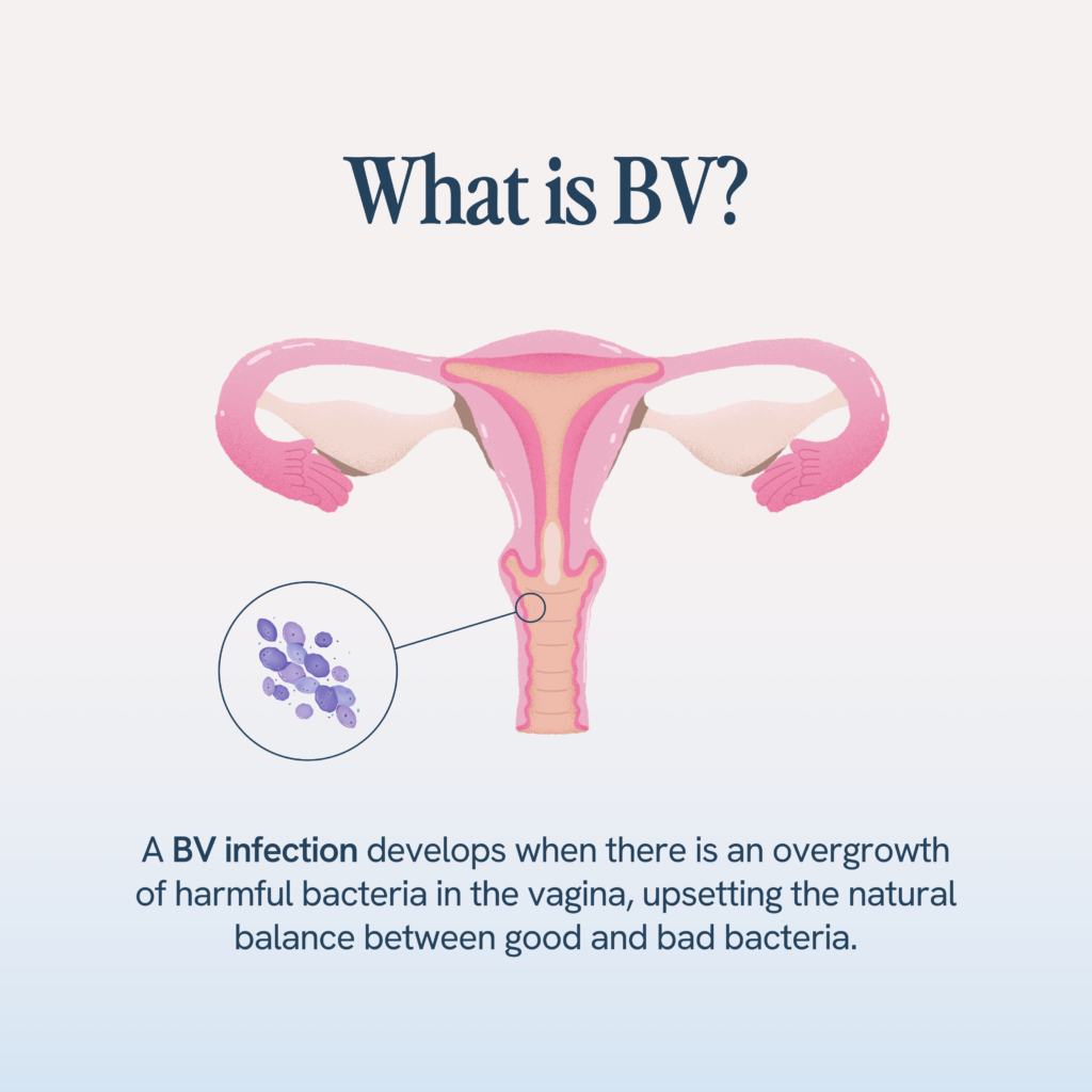 Bacterial vaginosis occurs from an imbalance in the vaginal environment, leading to an excess of harmful bacteria compared to beneficial ones.
