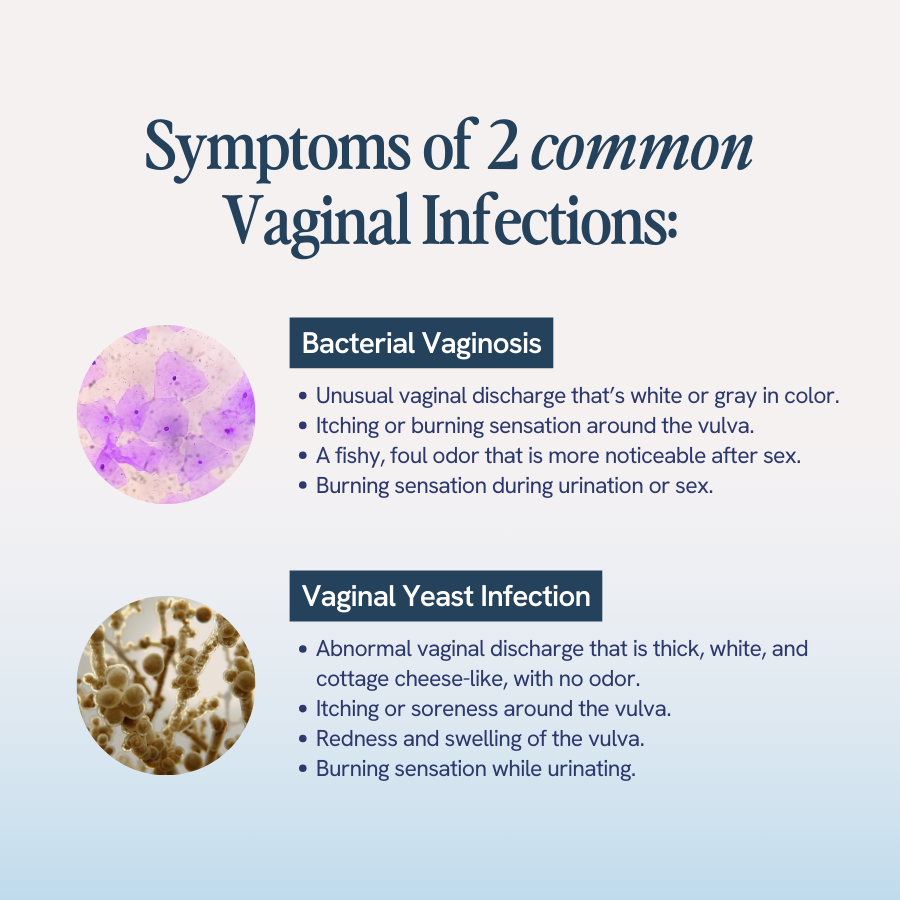 An image with the title ‘Symptoms of 2 common Vaginal Infections’ lists symptoms of bacterial vaginosis and vaginal yeast infection.
For Bacterial Vaginosis:
Unusual vaginal discharge that is white or gray in color.
Itching or burning sensation around the vulva.
A fishy, foul odor that is more noticeable after sex.
Burning sensation during urination or sex.
For Vaginal Yeast Infection:
Abnormal vaginal discharge that is thick, white, and cottage cheese-like, with no odor.
Itching or soreness around the vulva.
Redness and swelling of the vulva.
Burning sensation while urinating.
The image includes illustrations of bacteria and fungi.