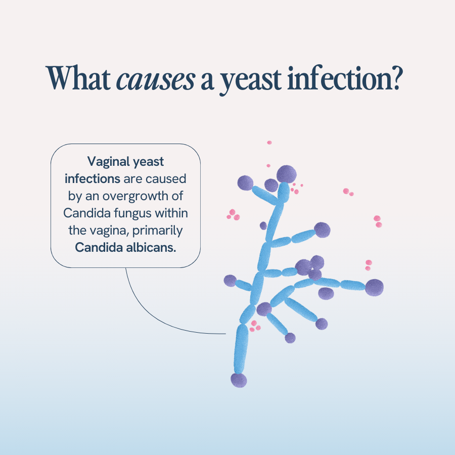 The image is a graphic explaining the cause of yeast infections. The title at the top reads, “What causes a yeast infection?” Below the title is an illustration of Candida fungus, depicted in blue and purple, with small pink spores around it. A text box on the left side of the image states, “Vaginal yeast infections are caused by an overgrowth of Candida fungus within the vagina, primarily Candida albicans.” The text box has an arrow pointing to the illustration of the fungus.
