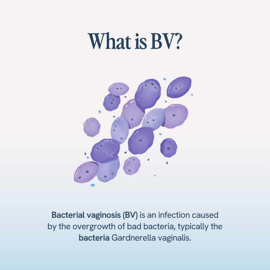 The image features a group of lavender-colored, spherical bacteria, representing Gardnerella vaginalis. The text reads, "What is BV? Bacterial vaginosis (BV) is an infection caused by the overgrowth of bad bacteria, typically the bacteria Gardnerella vaginalis."