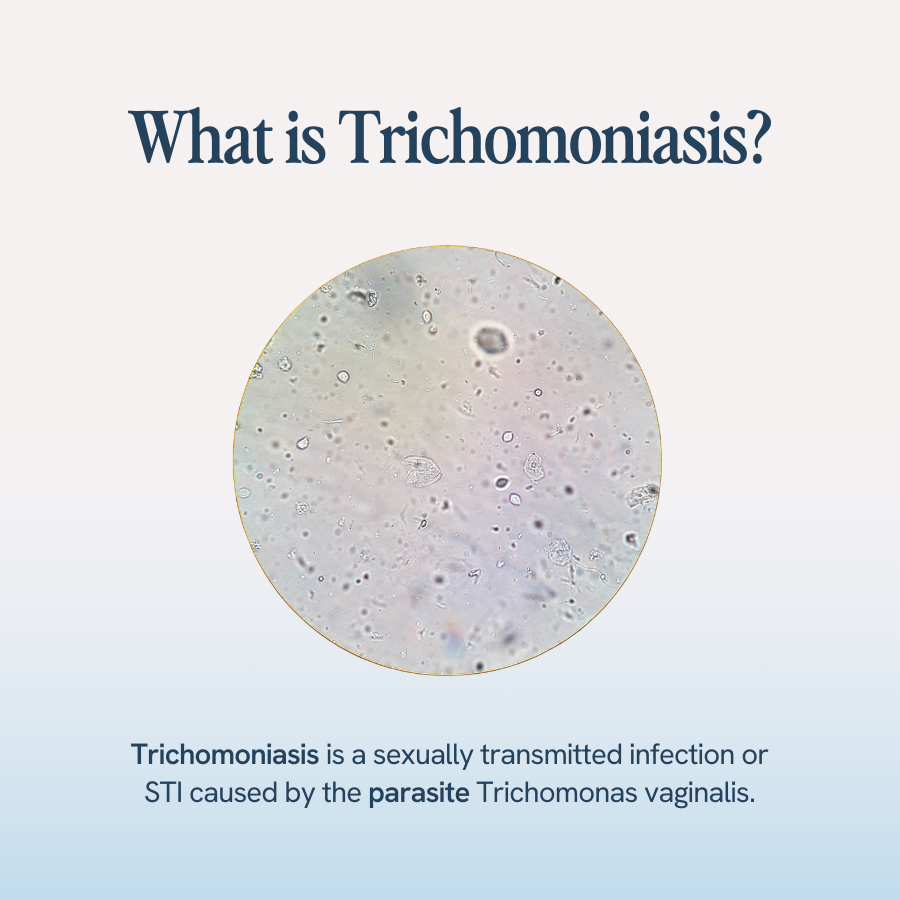 An image featuring the question "What is Trichomoniasis?" followed by text stating "Trichomoniasis is a sexually transmitted infestion of STI caused by the parasite Trichomonas vaginalis. 